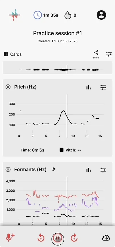 Animated Strivocal dashboard showing interactive voice analysis charts and saved recording feedback